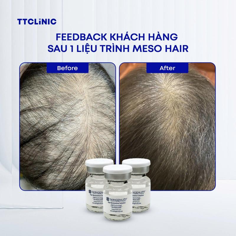 Phòng Khám Chuyên Khoa Da Liễu Thẩm Mỹ - TTCLiNIC