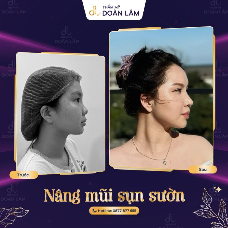 Phòng khám chuyên khoa Phẫu thuật Thẩm mỹ Dr Doãn Lâm.