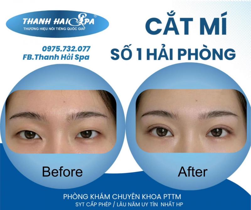 Phòng khám chuyên khoa phẫu thuật thẩm mỹ - Thanh Hải Spa