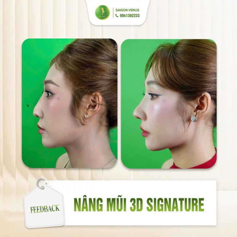 Phòng khám chuyên khoa PTTM Sài Gòn Venus