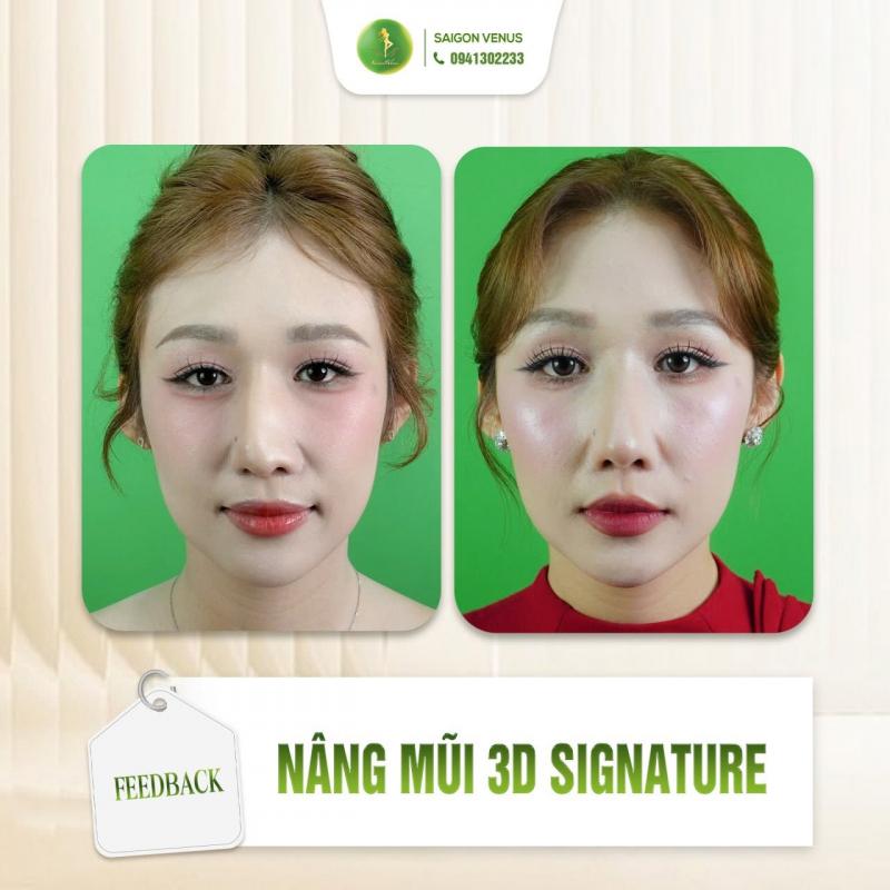 Phòng khám chuyên khoa PTTM Sài Gòn Venus