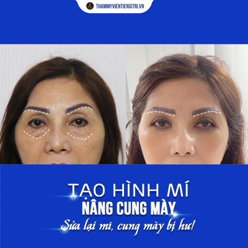 Phòng khám Chuyên Khoa Thẩm Mỹ Tiến sĩ Trí