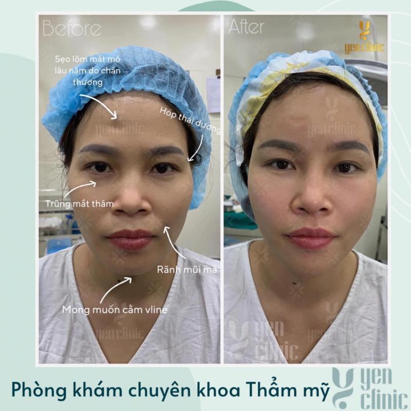 Phòng khám chuyên khoa Thẩm mỹ Yen Clinic