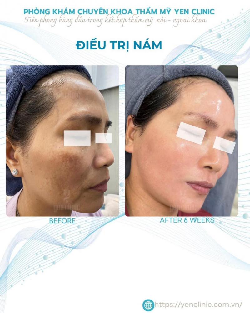Phòng khám chuyên khoa Thẩm mỹ Yen Clinic