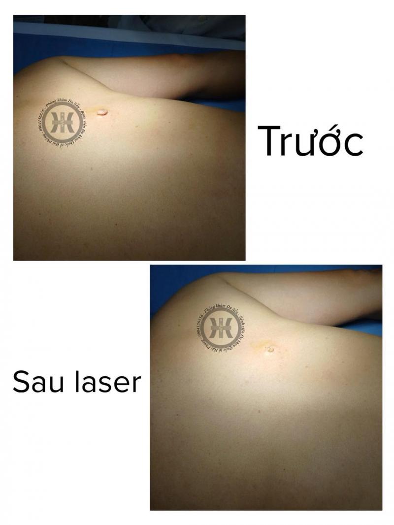 Phòng khám Da liễu Bệnh Viện Đa Khoa Quốc Tế Hải Phòng