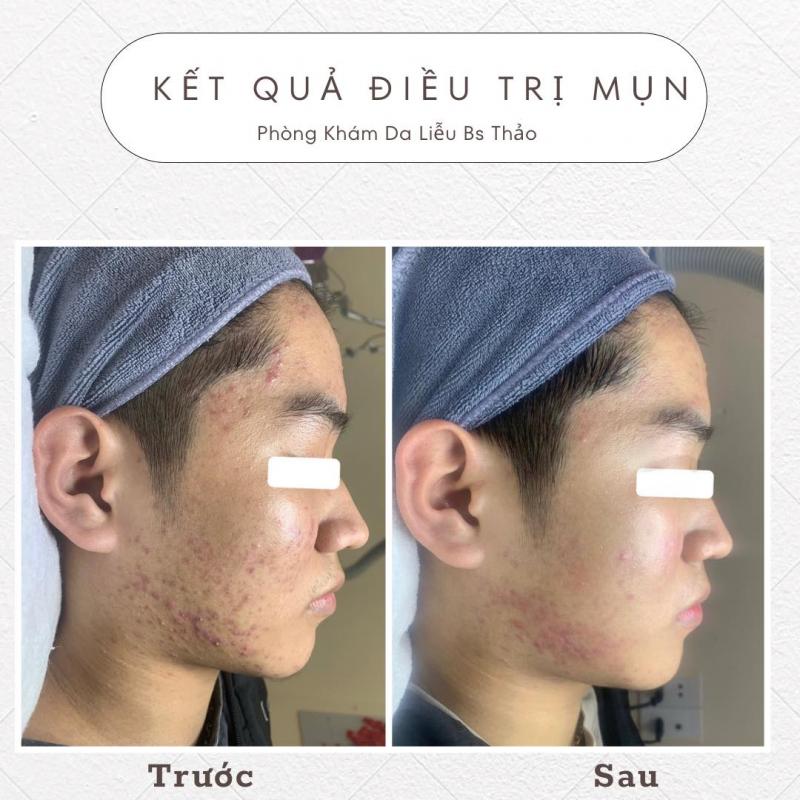 Phòng Khám Da Liễu Bs Thảo