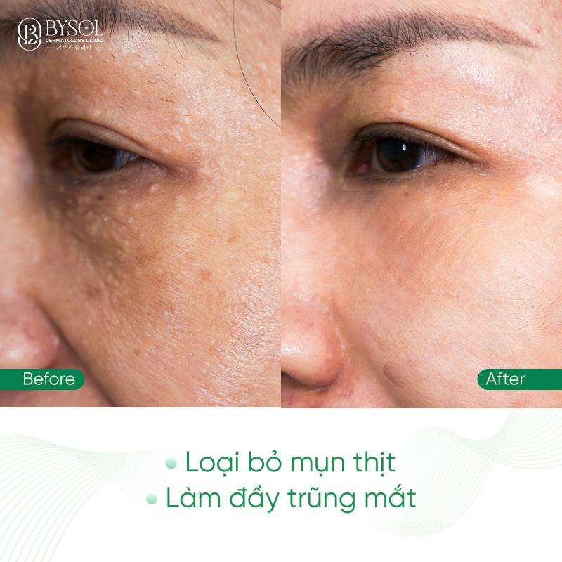 Phòng khám da liễu BYSOL