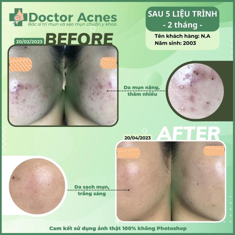 Phòng khám Da liễu Doctor Acnes