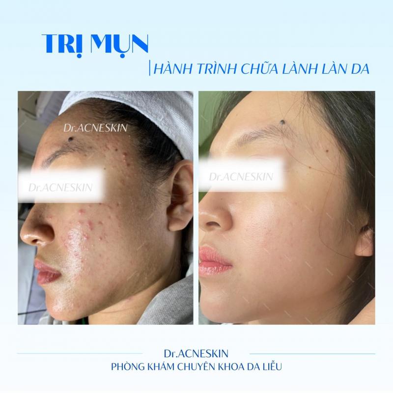 Phòng Khám Da Liễu Dr.Acneskin