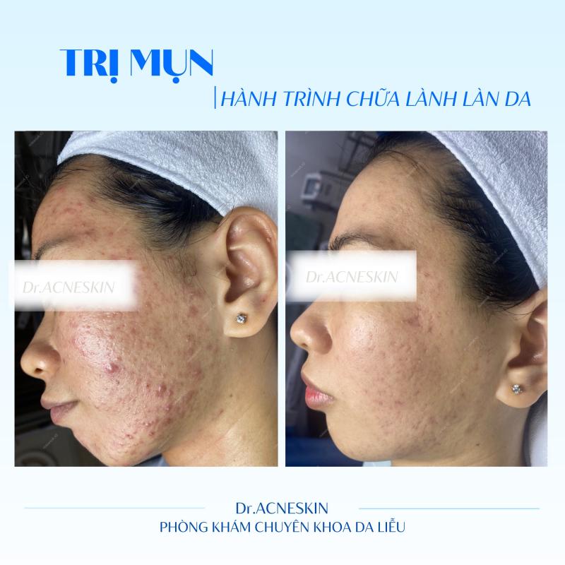 Phòng Khám Da Liễu Dr.Acneskin