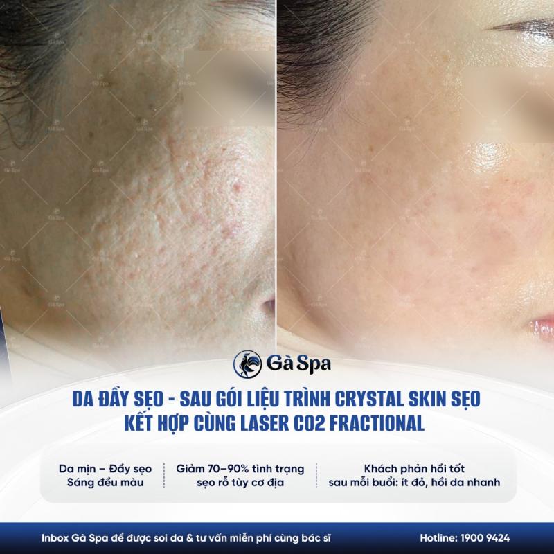 Phòng Khám Da Liễu Gà Spa