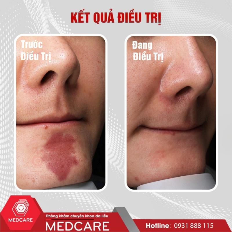 Phòng Khám Da Liễu Medcare - Medcare Skin Centre