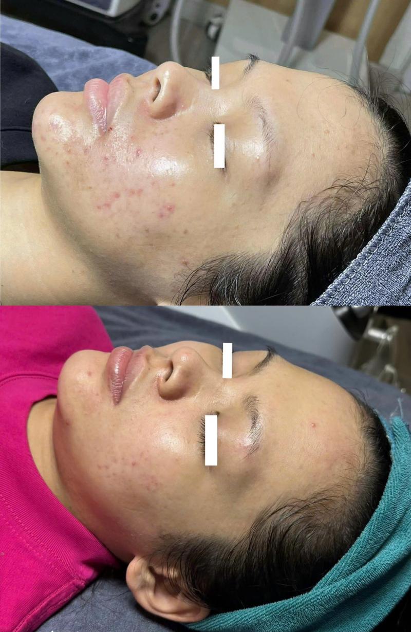 Phòng khám da liễu NU