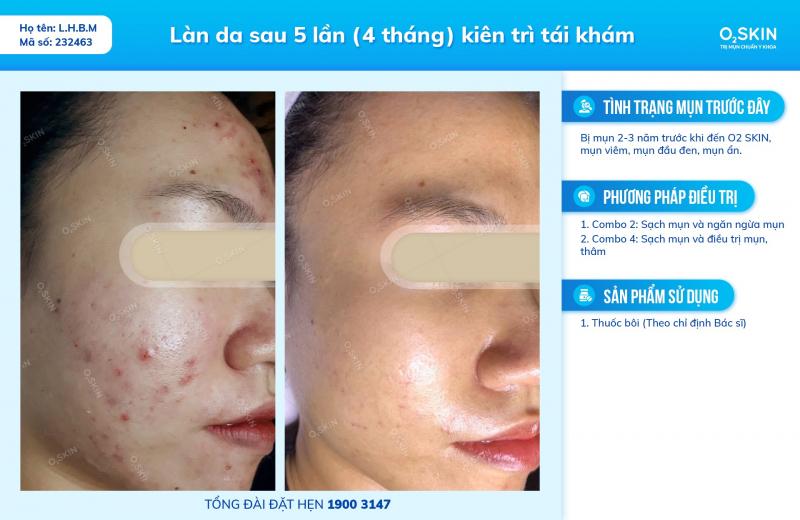 Phòng khám Da Liễu O2 SKIN