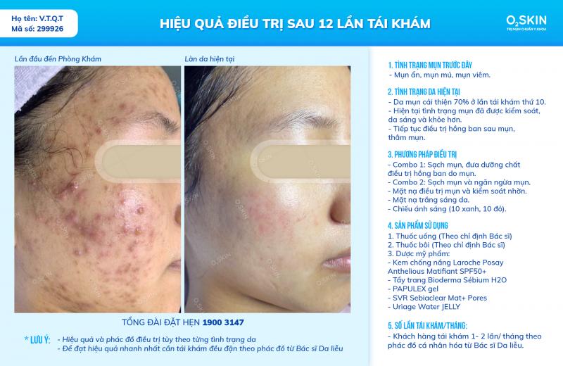 Phòng khám da liễu O2 SKIN