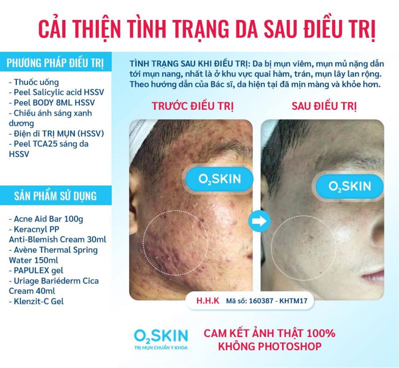 Phòng khám Da liễu O2 SKIN