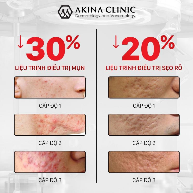 Phòng khám Da liễu Quốc tế AKINA Đà Nẵng - Dr Cao Nguyên