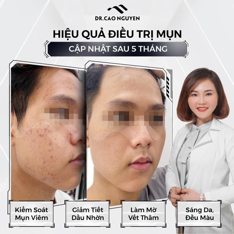 Phòng khám Da liễu Quốc tế AKINA Đà Nẵng - Dr Cao Nguyên