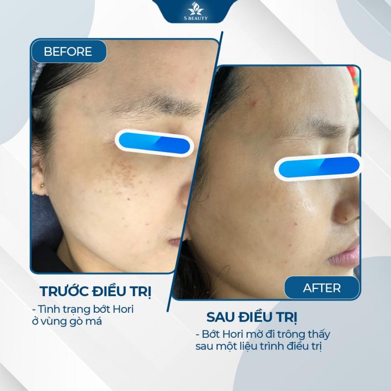 Phòng khám Da liễu S Beauty