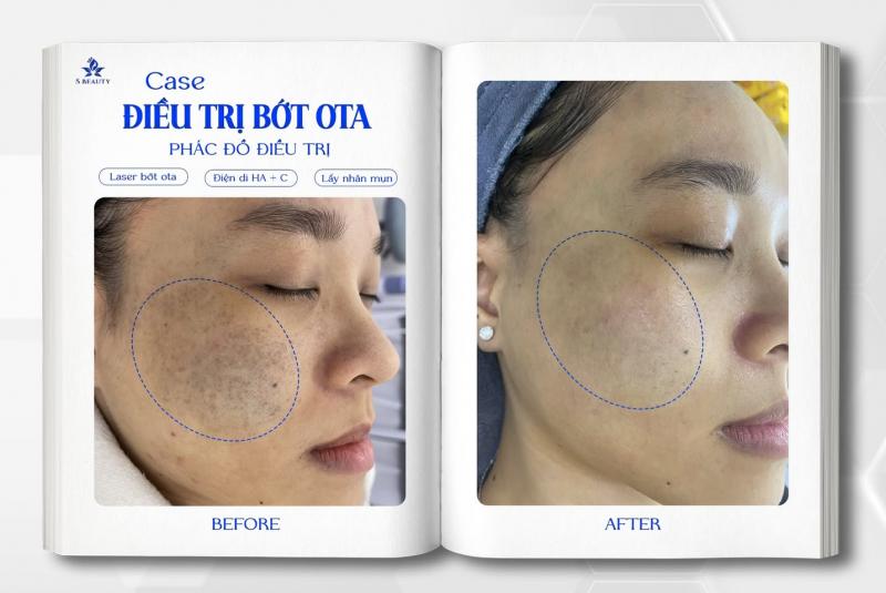 Phòng khám Da liễu S Beauty