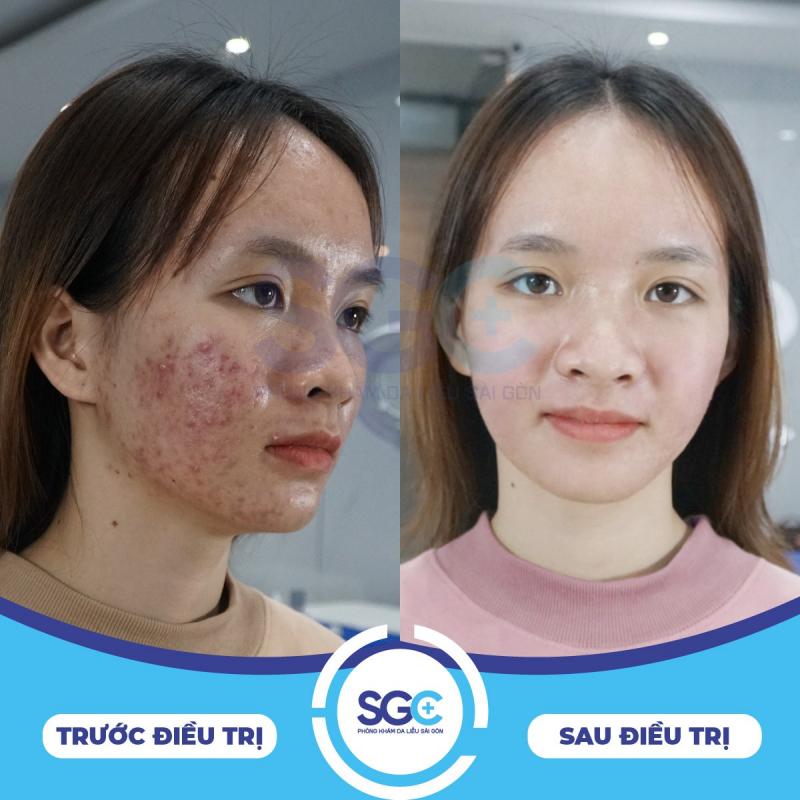 Phòng khám Da liễu Sài Gòn (SGC)