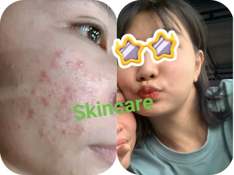 Phòng Khám Da Liễu Skincare