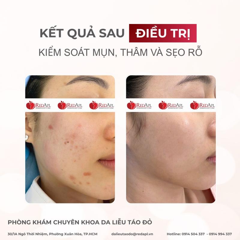 Phòng khám Da liễu Táo Đỏ