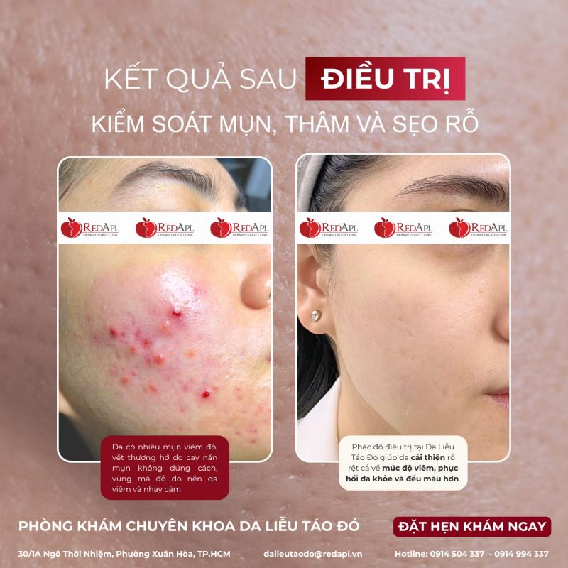 Phòng khám Da liễu Táo Đỏ