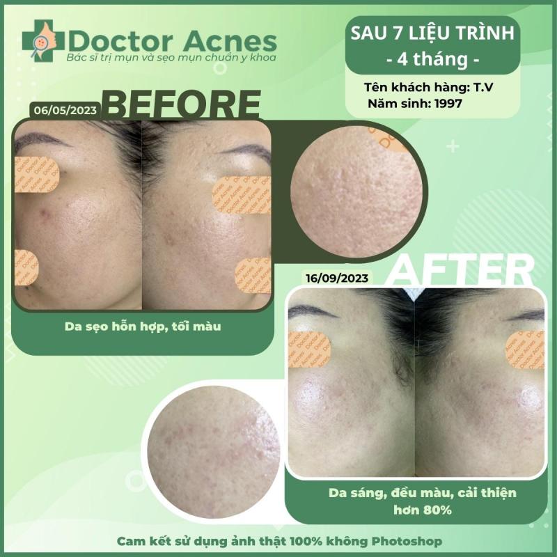 PHÒNG KHÁM DA LIỄU THẨM MỸ DOCTOR ACNES