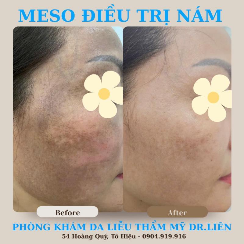 Phòng khám Da liễu - Thẩm mỹ Dr. Liên