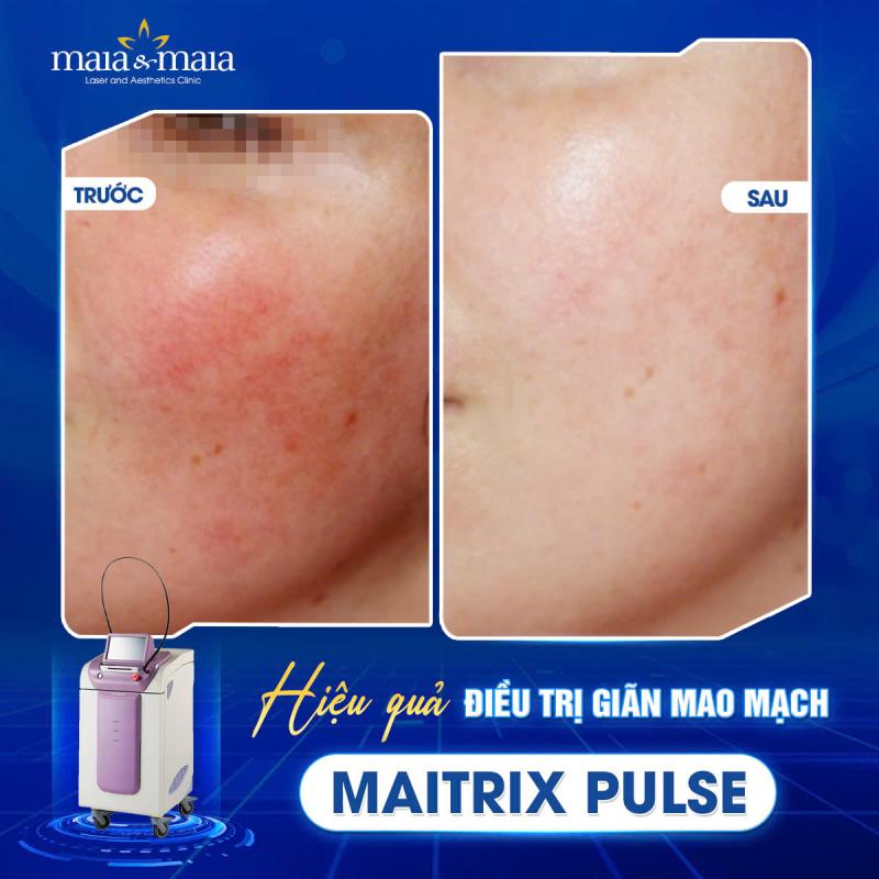 Phòng khám da liễu thẩm mỹ Maia & Maia