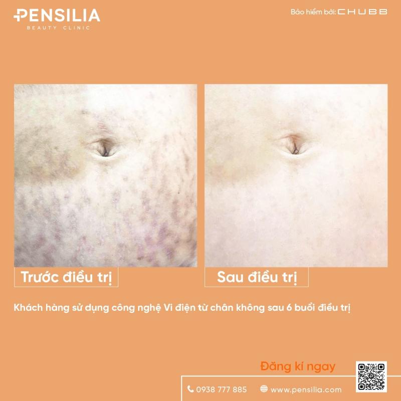 Phòng khám da liễu thẩm mỹ Pensilia