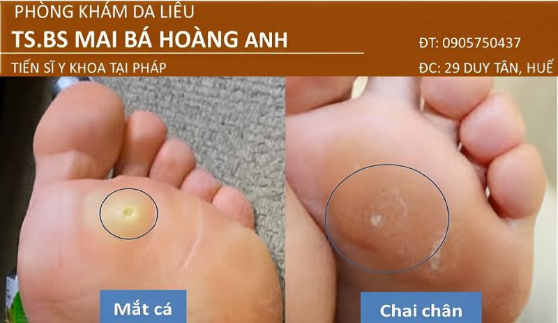 Phòng Khám Da Liễu TS.BS Mai Bá Hoàng Anh