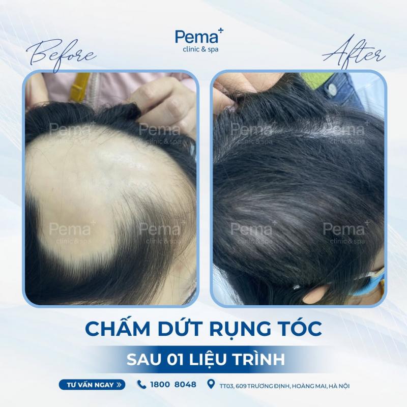 Phòng Khám Da liễu và Thẩm mỹ PEMA