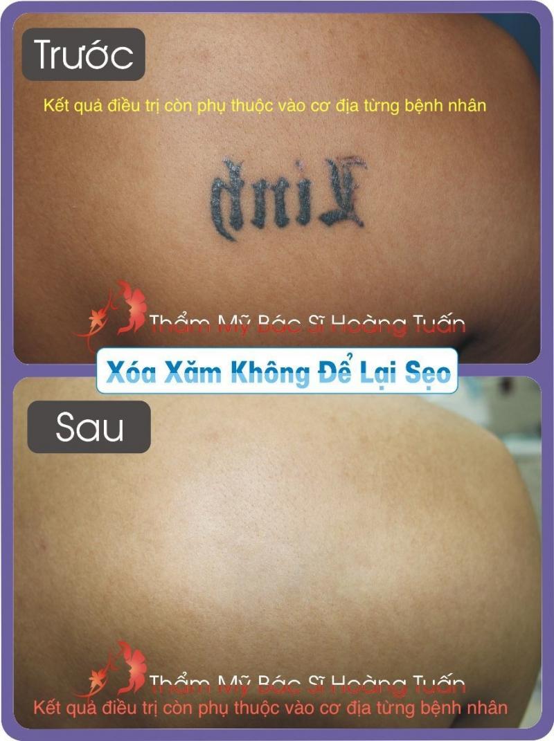 Phòng khám phẫu thật thẩm mỹ & da liễu Thẩm Mỹ Hoàng Tuấn