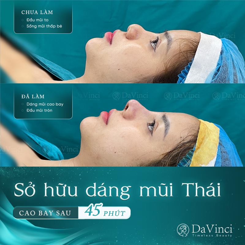 Phòng khám phẫu thuật thẩm mỹ Davinci