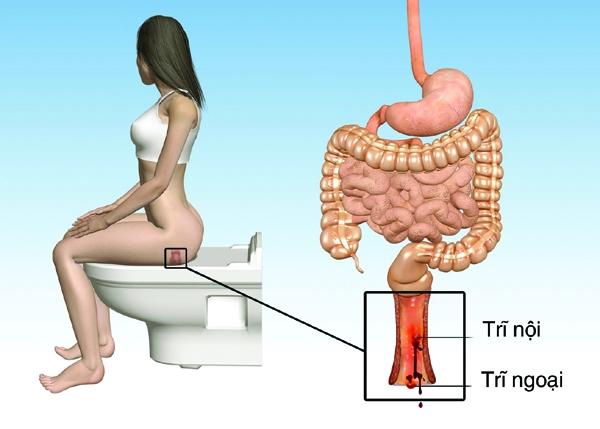 Một lý do hàng đầu dẫn đến bệnh trĩ ở phụ nữ chính là công việc văn phòng ngồi nhiều giờ liền liên tục.