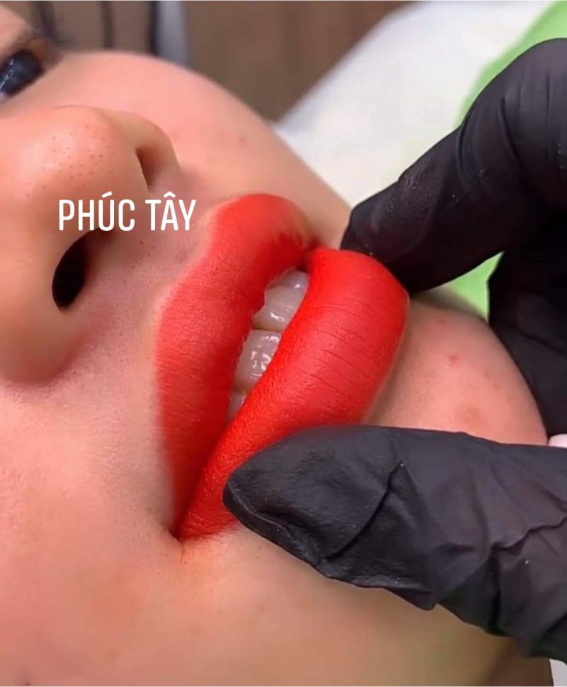 Thẩm Mỹ Phúc Tây