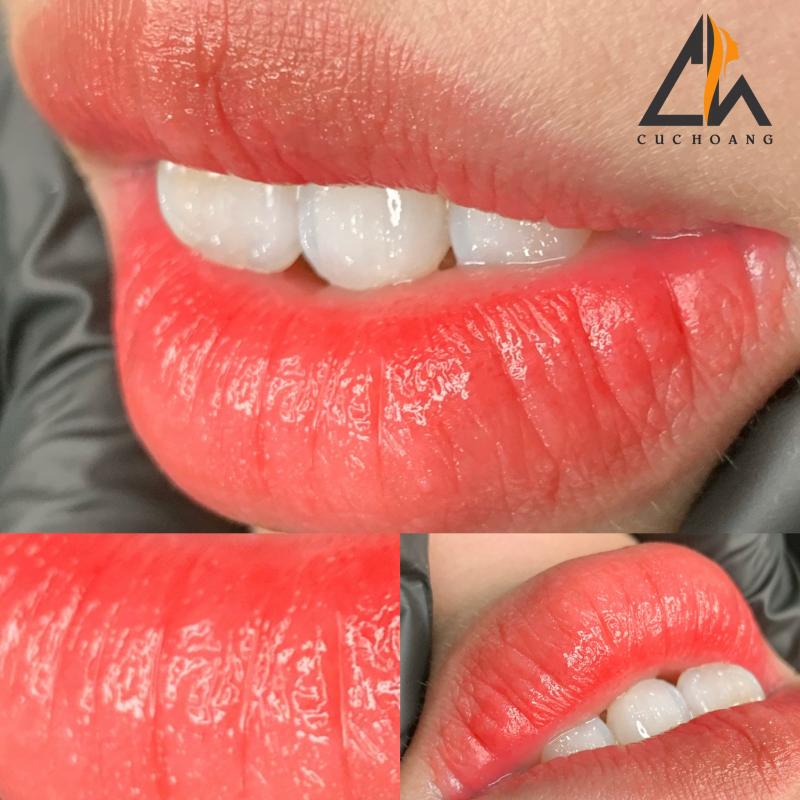 Phun thêu thẩm mỹ Cúc Hoàng