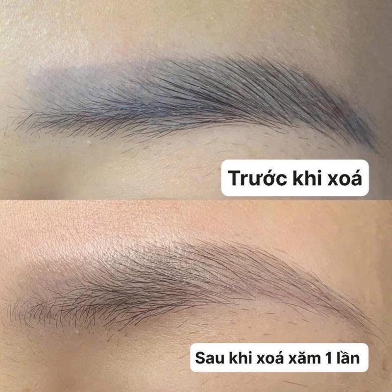 Phương Linh spa by Cô Trân