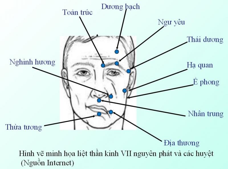 Phương pháp bấm huyệt