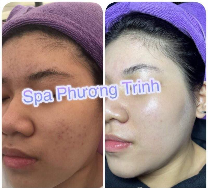 Phương Trinh Spa