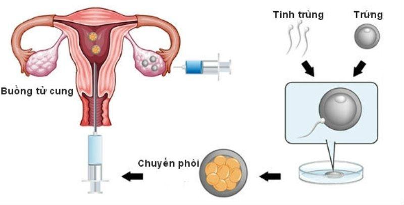 Sơ đồ mô tả quá trình thực hiện phương pháp TTON