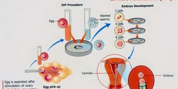 Quy trình thụ tinh ống nghiệm