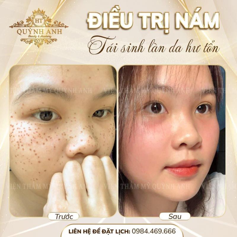 Quỳnh Anh Beauty & Academy