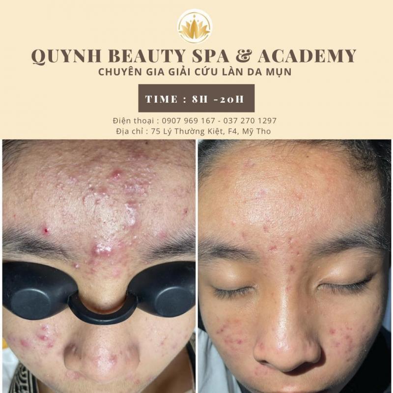 Quỳnh Beauty Spa