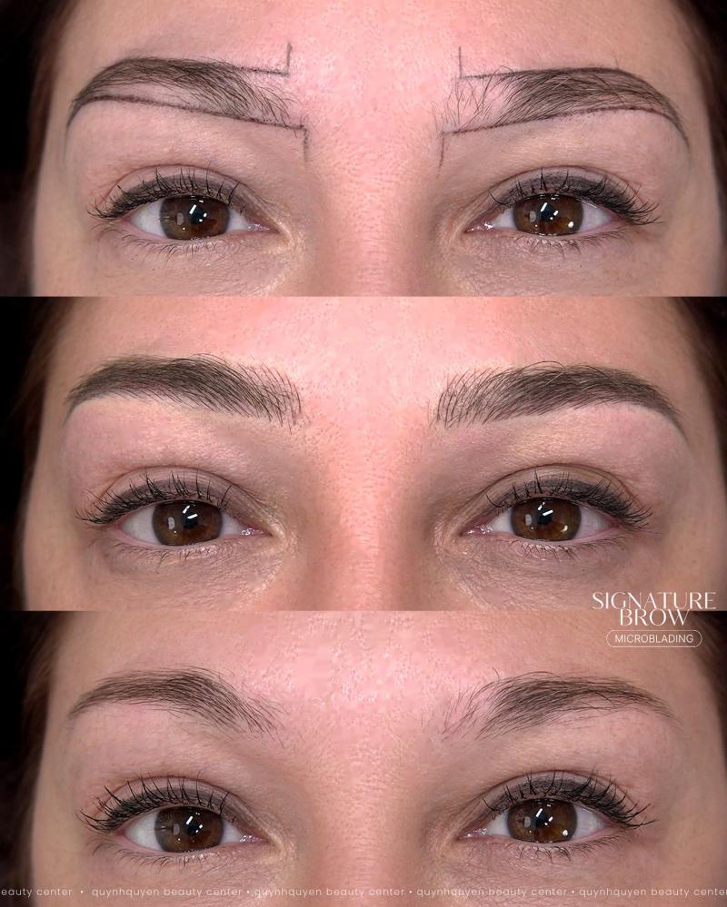 QuynhQuyen Beauty Center