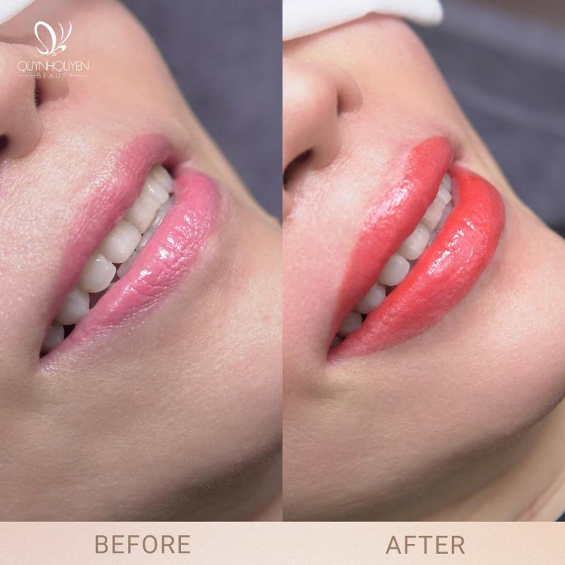 QuynhQuyen Beauty Center