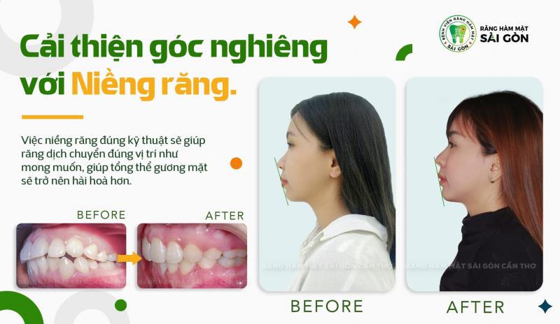 Răng Hàm Mặt Sài Gòn - Cần Thơ