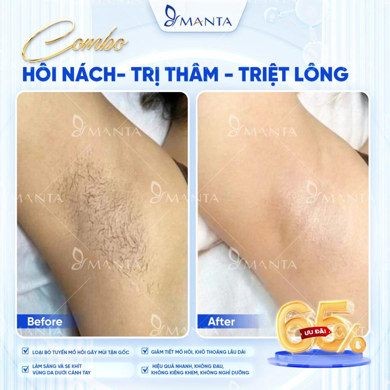 Royal Spa Bắc Ninh